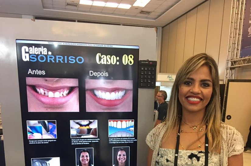 Odontologia Estética: Caso alagoano é um dos melhores do país em 2016