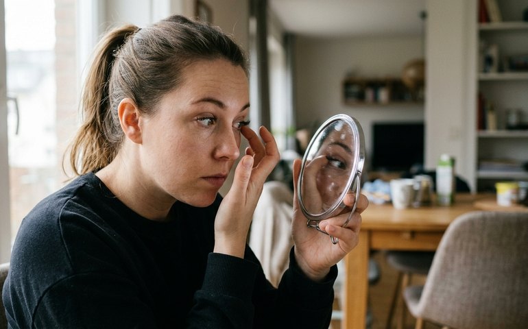 Mulher descobre tumor cerebral após notar alteração ao remover cílios postiços