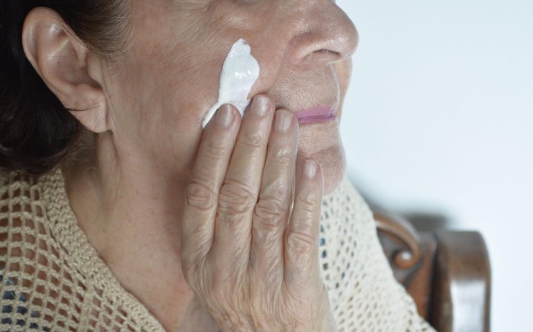 Dezembro Laranja: dermatologista da Sesau orienta sobre os cuidados para evitar o câncer de pele no verão