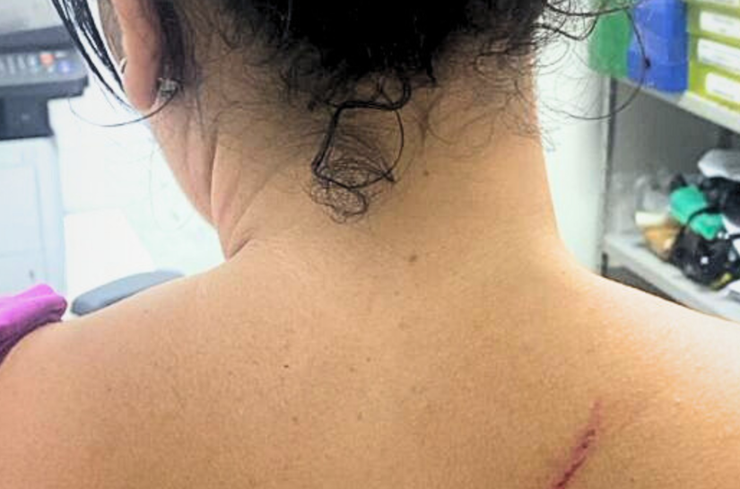Homem é preso em flagrante por agressão à ex-companheira e filha de 8 anos em Arapiraca