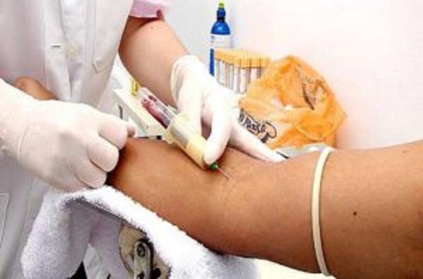 Saiba como fazer o diagnóstico de doenças transmitidas pelo aedes