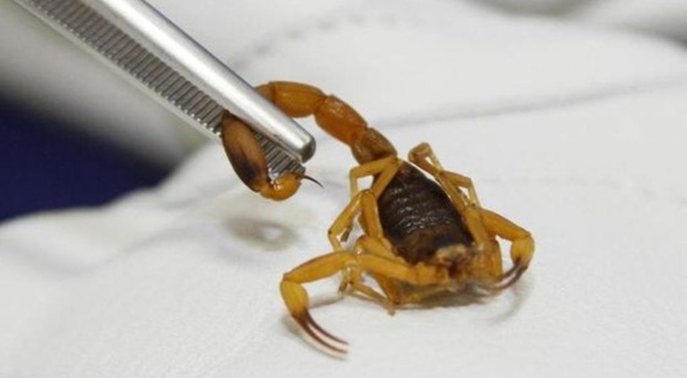 homem-e-picado-por-escorpiao-amarelo-em-cianorte-5c24a97b5b628.jpg / Foto: foto:  reprodução Agência Brasil