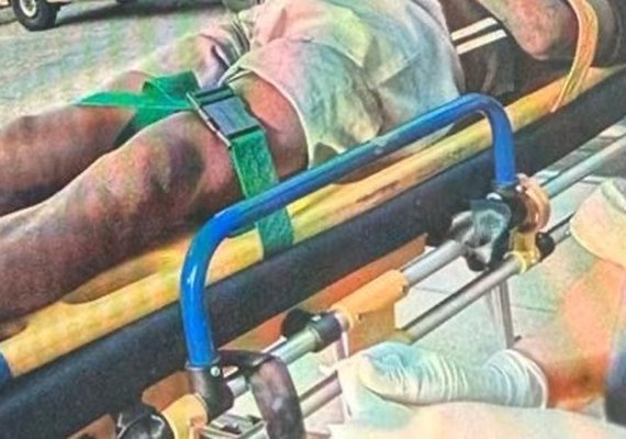 Polícia investiga acidente com fio de energia que quase degolou motociclista