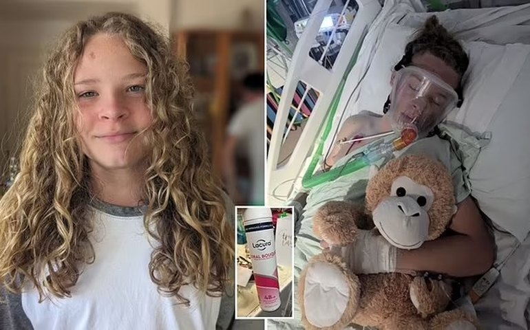 Menino de 12 anos sofre parada cardíaca e convulsões após seguir 'trend' de inalação com desodorante; entenda o caso