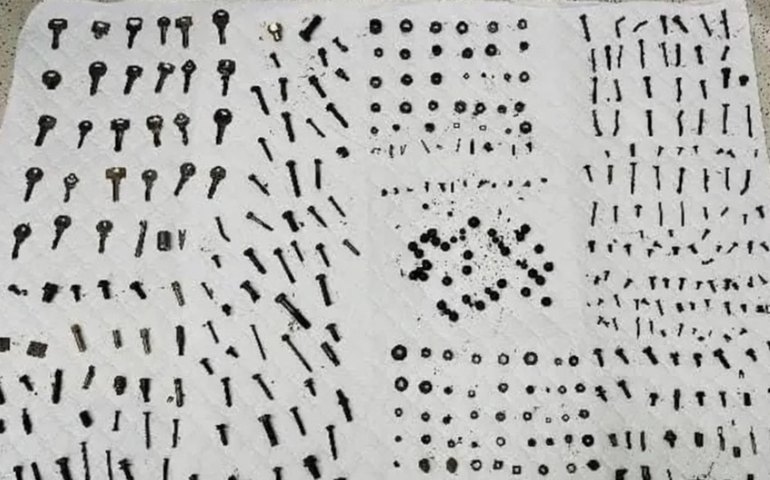 Médicos no Irã removem 452 objetos de metal do estômago de homem