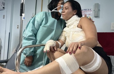 Cirurgião Plástico do HGE alerta para o risco de queimaduras durante o cozimento de alimentos
