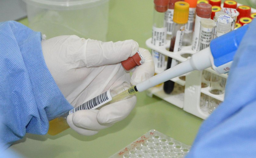 Com 7 casos este ano em Alagoas, Sesau reforça medidas de prevenção contra meningite