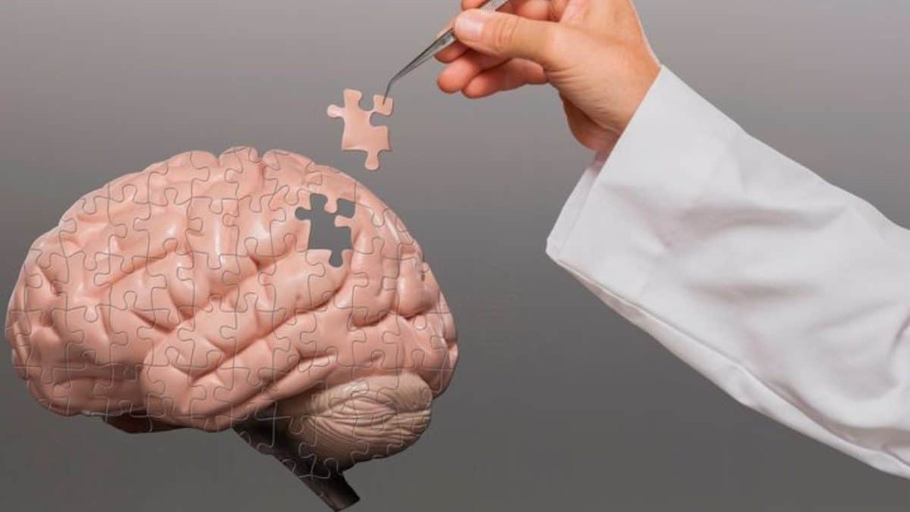 Cientistas defendem uso do Viagra para o tratamento do Alzheimer; entenda