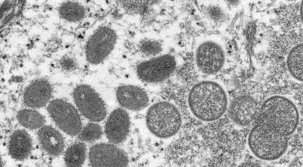 variola-macaco-20052022091640803.jpeg / Foto: CYNTHIA S. GOLDSMITH, RUSSELL REGNERY/CDC VIA REUTERS