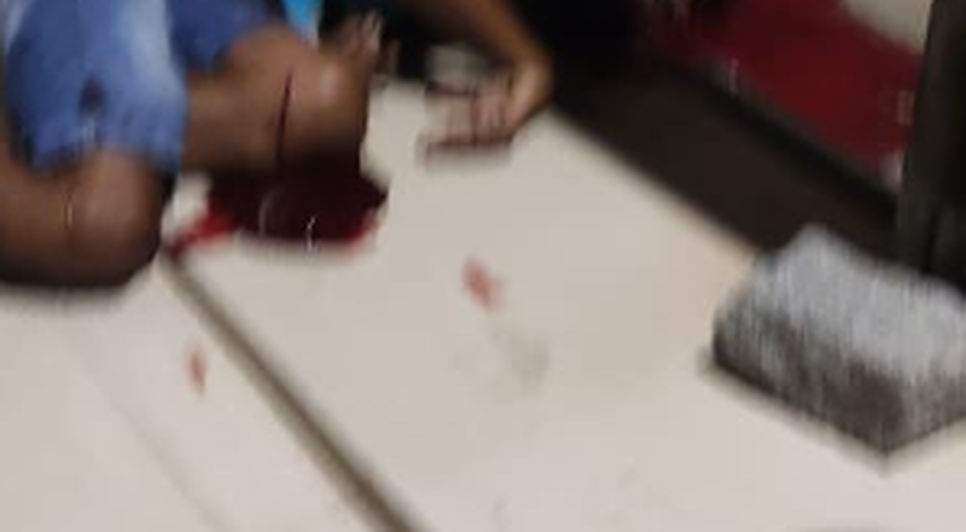 Homem é morto com tiros na cabeça e duas pessoas ficam feridas em Aracaju