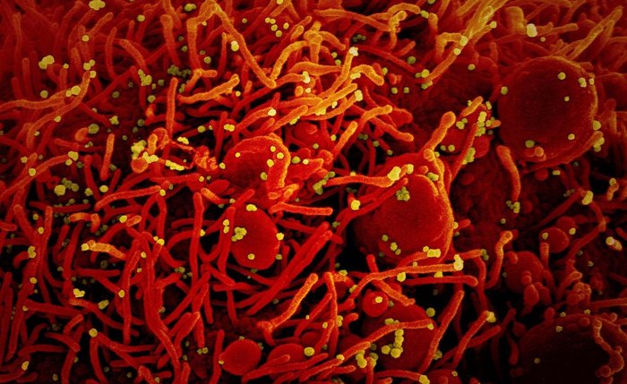 Coronavírus em célula humana
