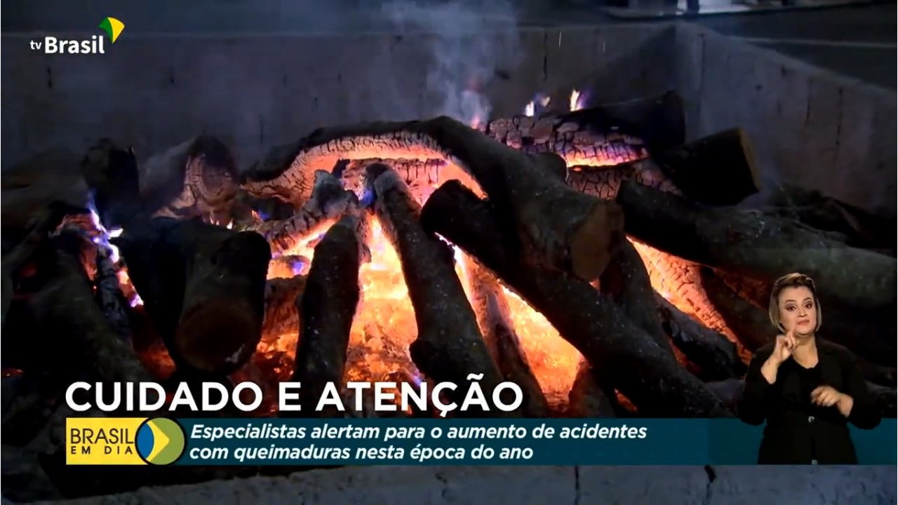Queimaduras levam 150 mil pessoas a serem internadas por ano no país