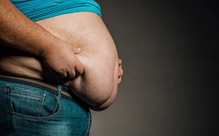 A obesidade está associada a 10% das mortes por infecção em todo o mundo, diz novo estudo da Lancet