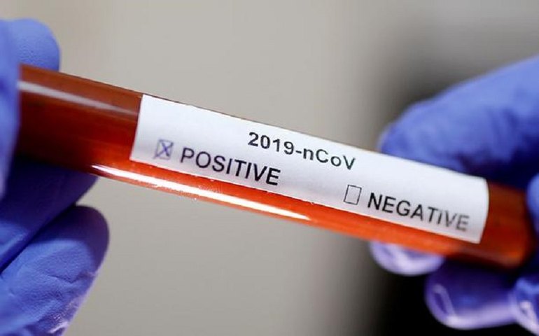 COVID-19: Palmeira tem 2.232 casos de coronavírus