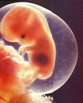 China tem 13 milhões de aborto por ano