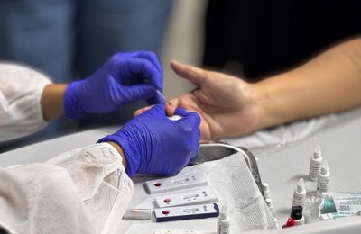 Dia Mundial de Luta contra as Hepatites Virais: 6 formas de  prevenir a doença