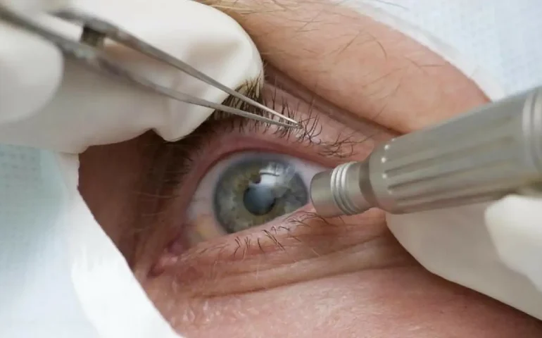 Abril marrom alerta para prevenção e tratamento da cegueira