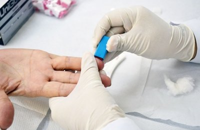 Helvio Auto fará testes para detectar hepatites B e C abertos à população