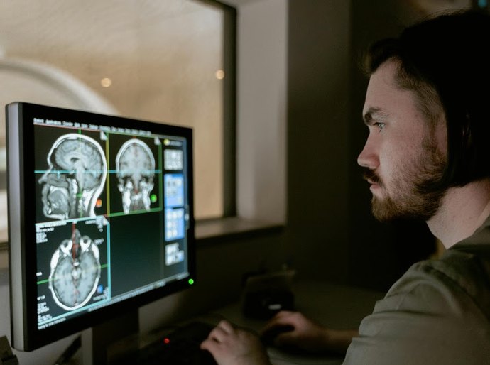 Maio Cinza: sinais de tumor cerebral vão além da dor de cabeça
