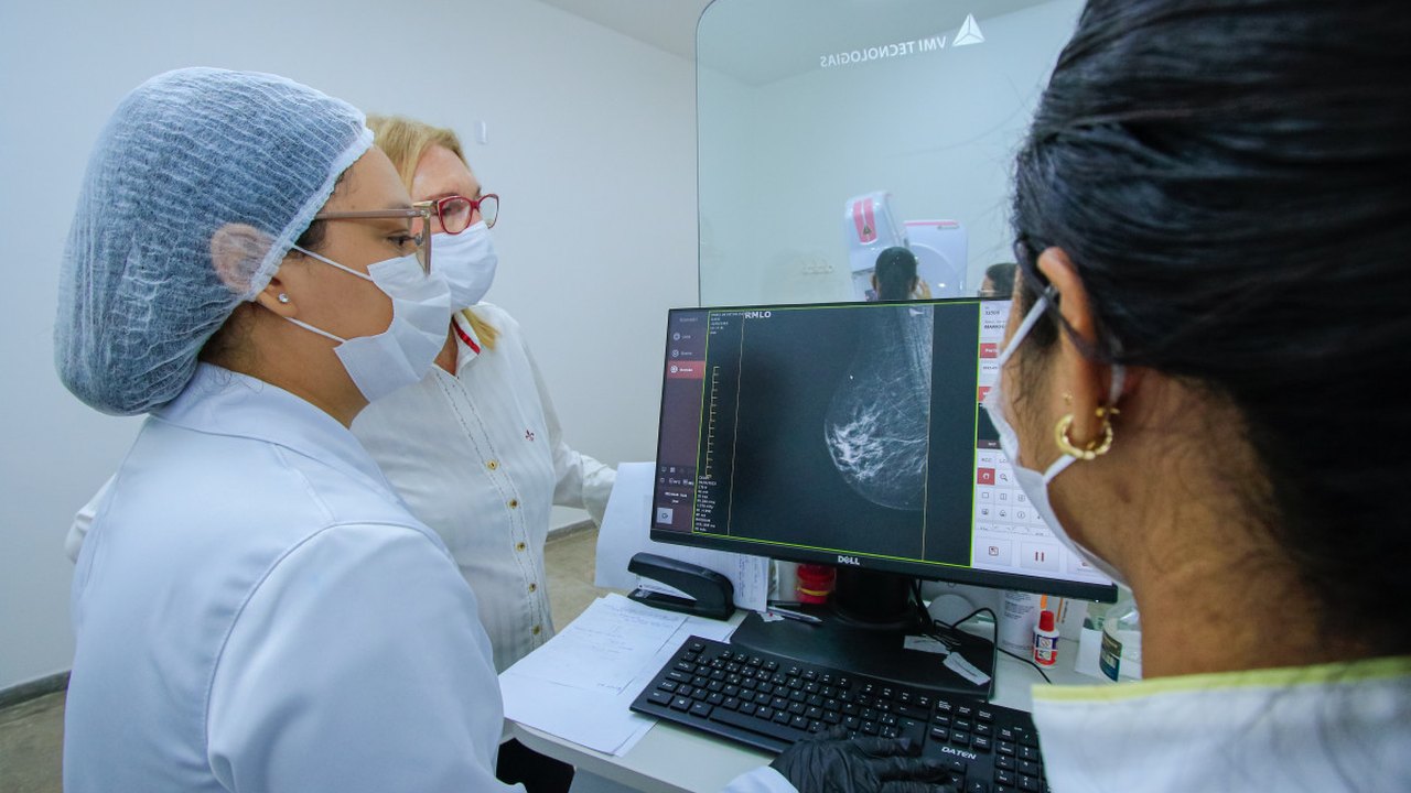 Uncisal disponibiliza 5 mil exames de mamografia até o fim do ano