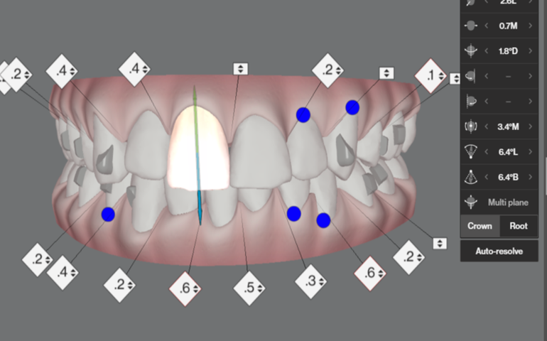 Ortodontia Digital: evento on-line capacita profissionais