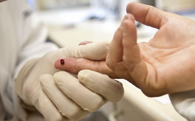 Pacientes testam positivo para HIV após transplante no RJ