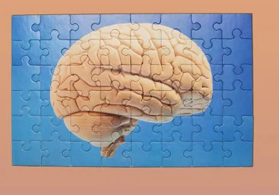 Cientista prevê desenvolvimento de remédio para Alzheimer até 2040