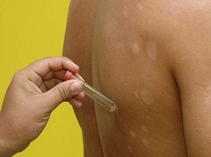 Sesau capacita técnicos municipais para campanha