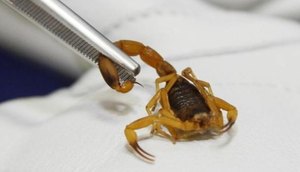 homem-e-picado-por-escorpiao-amarelo-em-cianorte-5c24a97b5b628.jpg / Foto: foto:  reprodução Agência Brasil