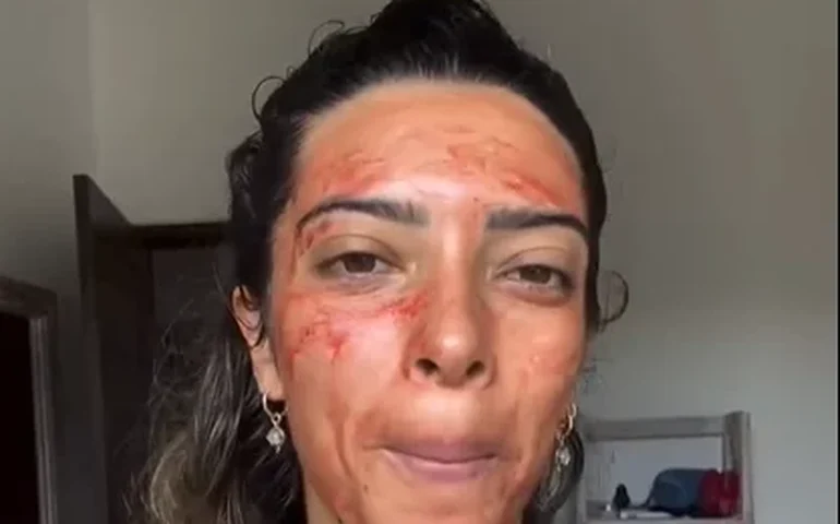 Máscara com sangue menstrual volta a viralizar: dermatologistas alertam para riscos