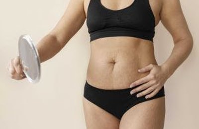 Emagreceu e a pele ficou flácida? Conheça quatro tecnologias que podem ajudar a recuperar a firmeza