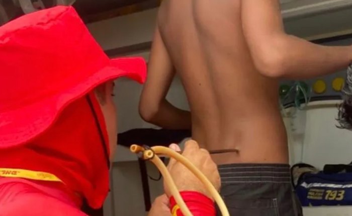 Adolescente é atingido por arpão usado em pesca subaquática