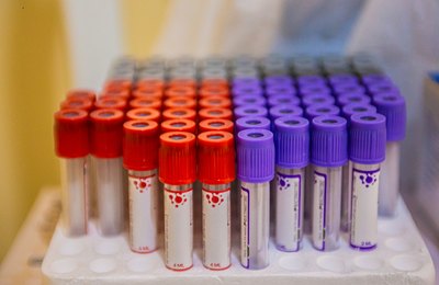 Arapiraca: Parceria com laboratório de análises clínicas garante check-up para população em situação de rua