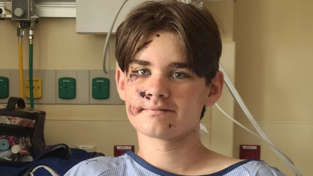 Adolescente de 13 anos sobrevive depois de cair de penhasco de 30 metros