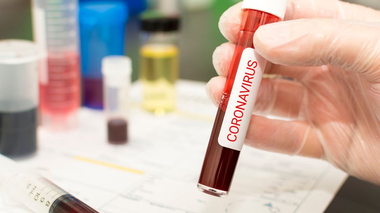 Boletim Epidemiológico: Palmeira está há 48h sem notificações, novos casos suspeitos ou monitorados de coronavírus