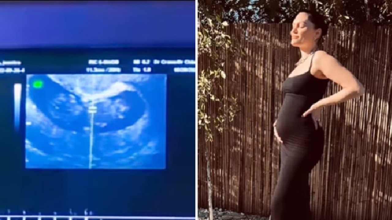 Jessie J anuncia gravidez após sofrer aborto espontâneo