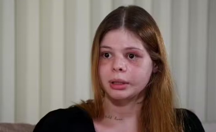 Médica que teve o rosto desfigurado Médica que teve o rosto desfigurado