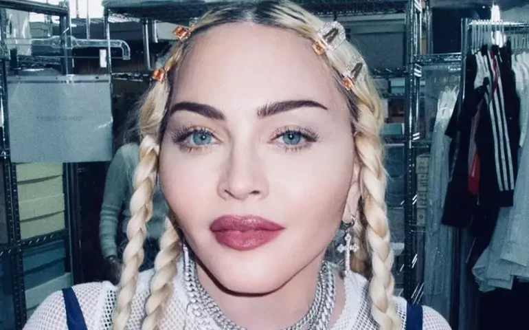 Madonna é internada por infecção bacteriana e adia turnê: 'Expectativa de recuperação total'