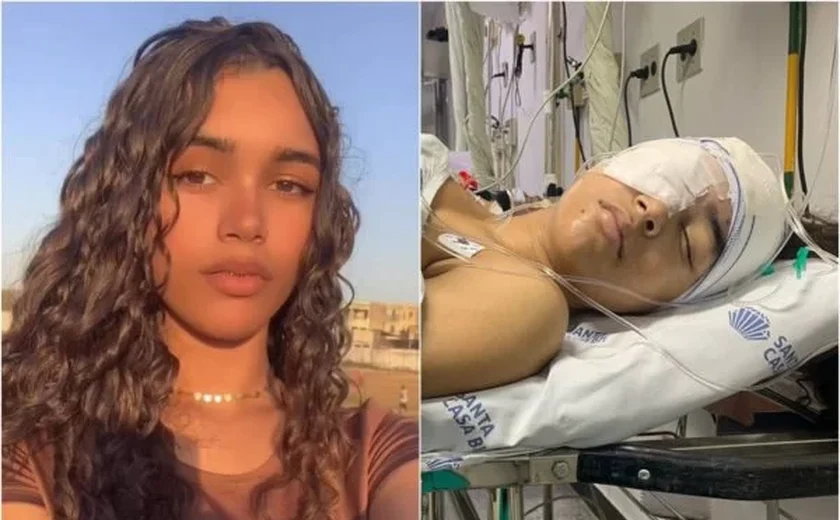 “Foi assustador”, diz jovem que quase ficou cega por causa de sinusite