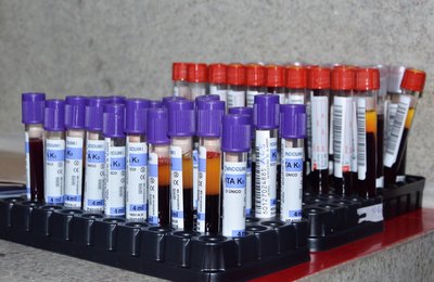 Hemoal promove cadastro para doação de medula no Centro Universitário Mário Jucá nesta sexta (12)