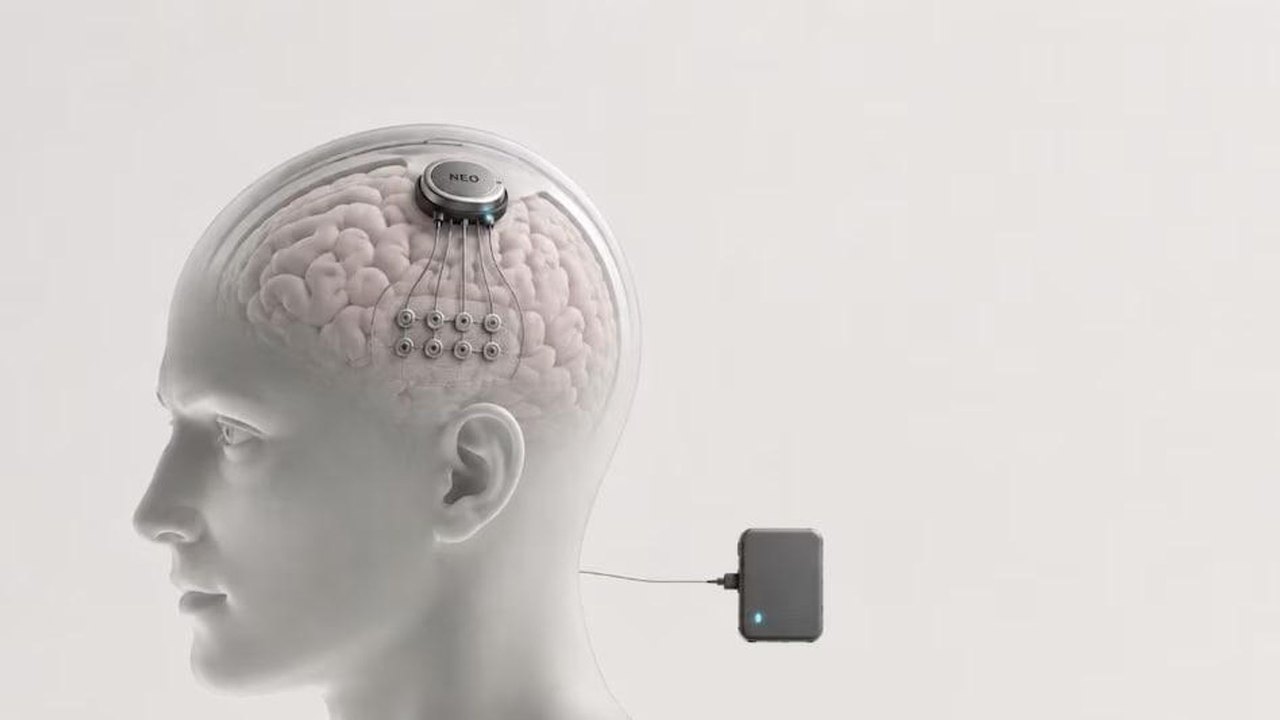A China está construindo uma indústria de chips cerebrais e pode superar a Neuralink na adoção em massa