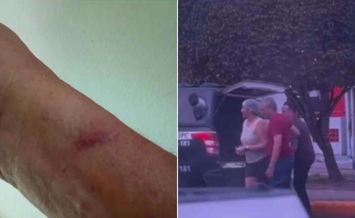 Em vídeo, ex-paciente mostra cicatrizes causadas enquanto estava internado