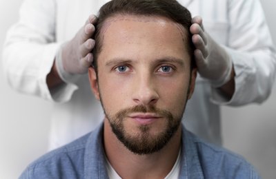 Transplante capilar virou investimento na carreira? Homens buscam aparência mais jovem no trabalho