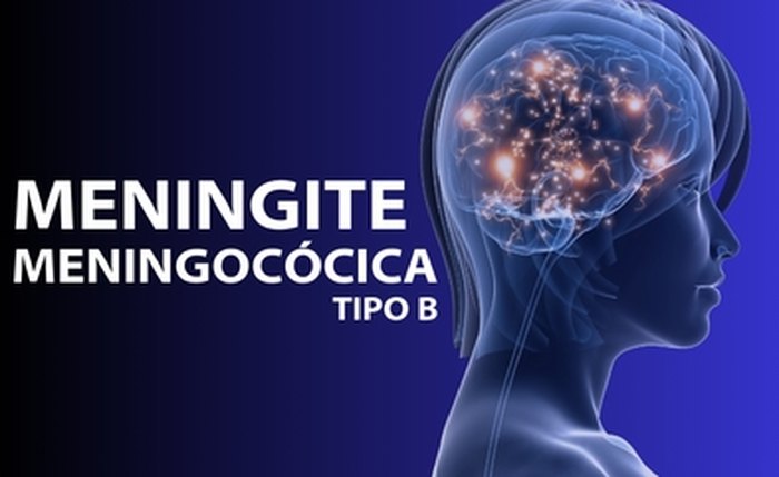 Meningite
