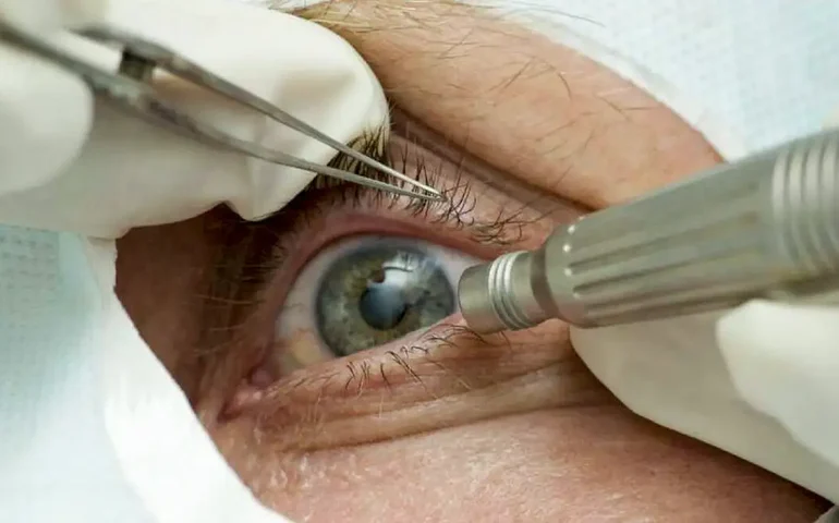 'Arminhas' de gel levam jovens à emergência por lesões oculares; especialistas fazem alerta