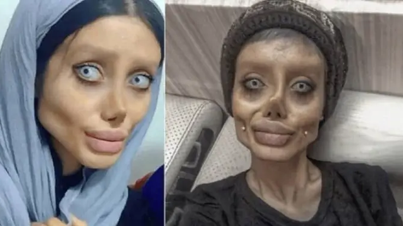 ‘Angelina Jolie Zumbi’ revela seu rosto pela 1ª vez após deixar prisão no Irã