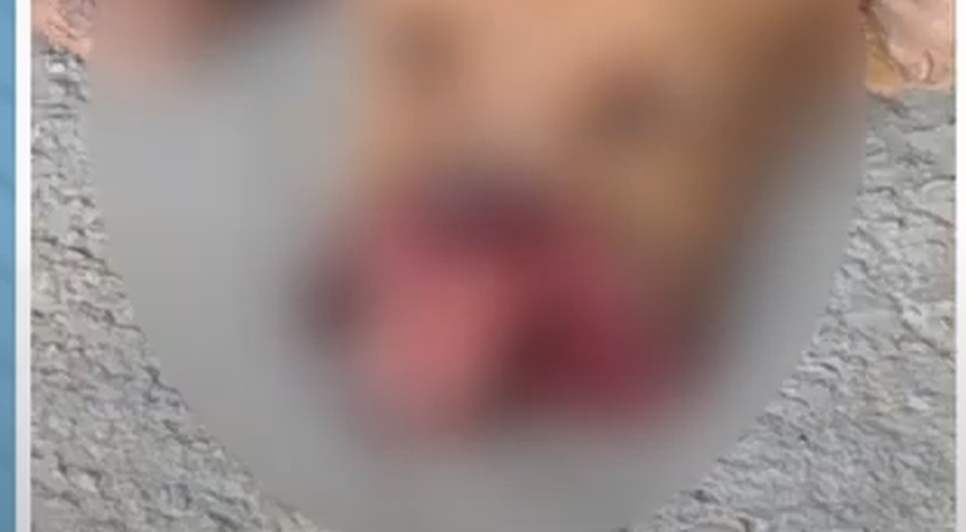 Capturar