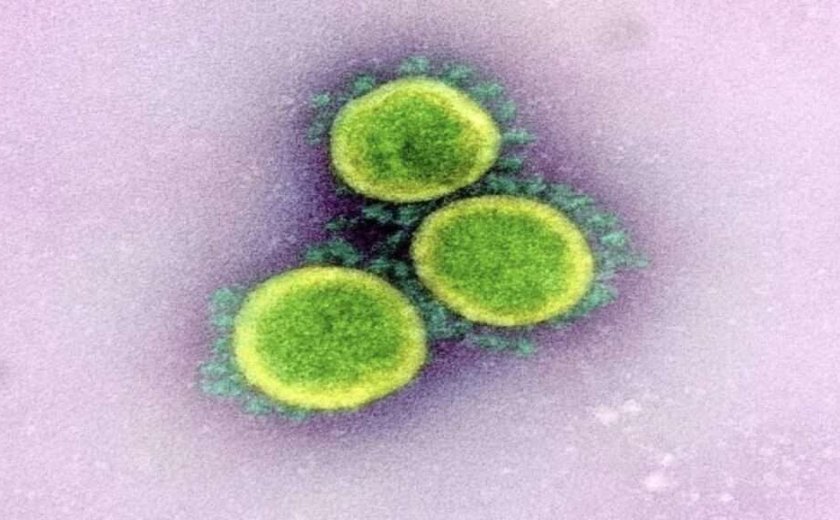 Variante 'Nimbus' da COVID-19 se espalha nos EUA com sintoma incomum: dor de garganta extrema