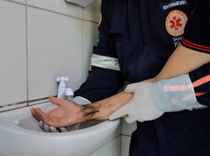 Sesau orienta sobre os primeiros socorros no caso de queimadura