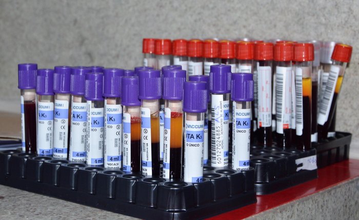 Para se cadastrar como doador de medula óssea, é preciso necessário doar 5 ml de sangue para analisar o código genético Para se cadastrar como doador de medula óssea, é preciso necessário doar 5 ml de sangue para analisar o código genético